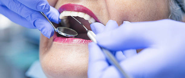 Best Emergency Tooth Extraction in Mountain Home, NC